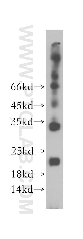 Western Blot (WB) analysis of MCF-7 cells using TMEM27 Polyclonal antibody (14571-1-AP)