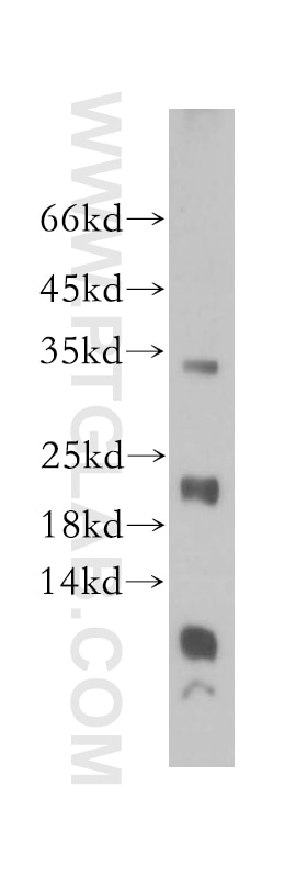 Western Blot (WB) analysis of human spleen tissue using TMEM27 Polyclonal antibody (14571-1-AP)