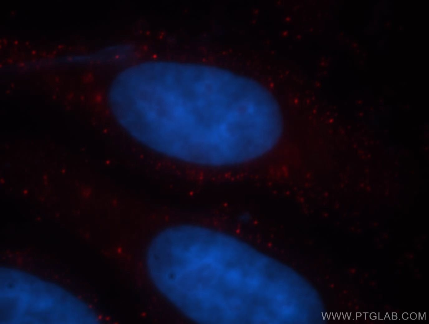 Immunofluorescence (IF) / fluorescent staining of HepG2 cells using TMEM27 Polyclonal antibody (19207-1-AP)