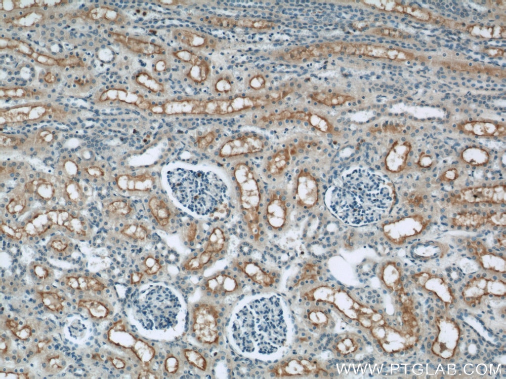 Immunohistochemistry (IHC) staining of human kidney tissue using TMEM27 Polyclonal antibody (19207-1-AP)