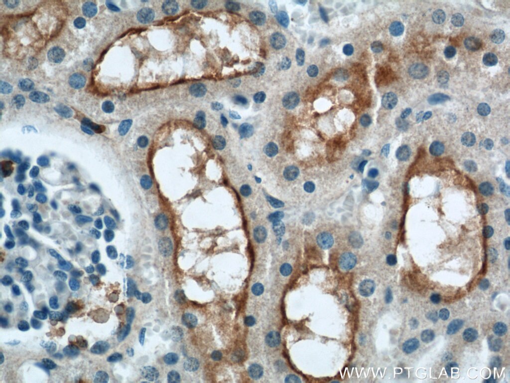 Immunohistochemistry (IHC) staining of human kidney tissue using TMEM27 Polyclonal antibody (19207-1-AP)