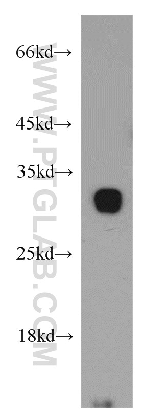 Western Blot (WB) analysis of mouse pancreas tissue using TMEM27 Polyclonal antibody (19207-1-AP)