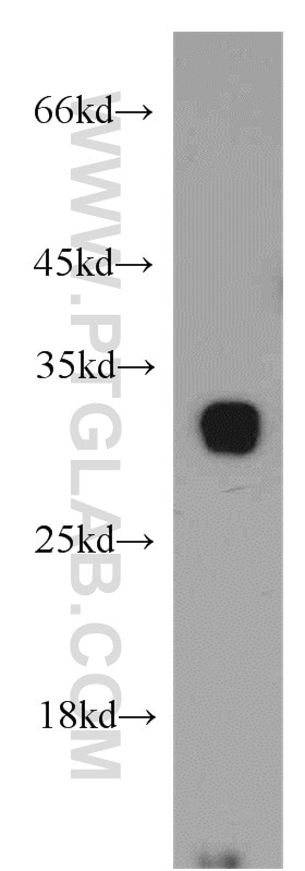 WB analysis of mouse pancreas using 19207-1-AP