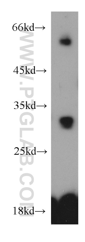 Western Blot (WB) analysis of mouse kidney tissue using TMEM27 Polyclonal antibody (19207-1-AP)