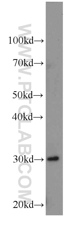 Western Blot (WB) analysis of mouse kidney tissue using TMEM27 Polyclonal antibody (19207-1-AP)