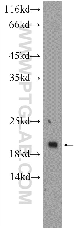 Western Blot (WB) analysis of HEK-293 cells using TMEM27 Polyclonal antibody (24059-1-AP)