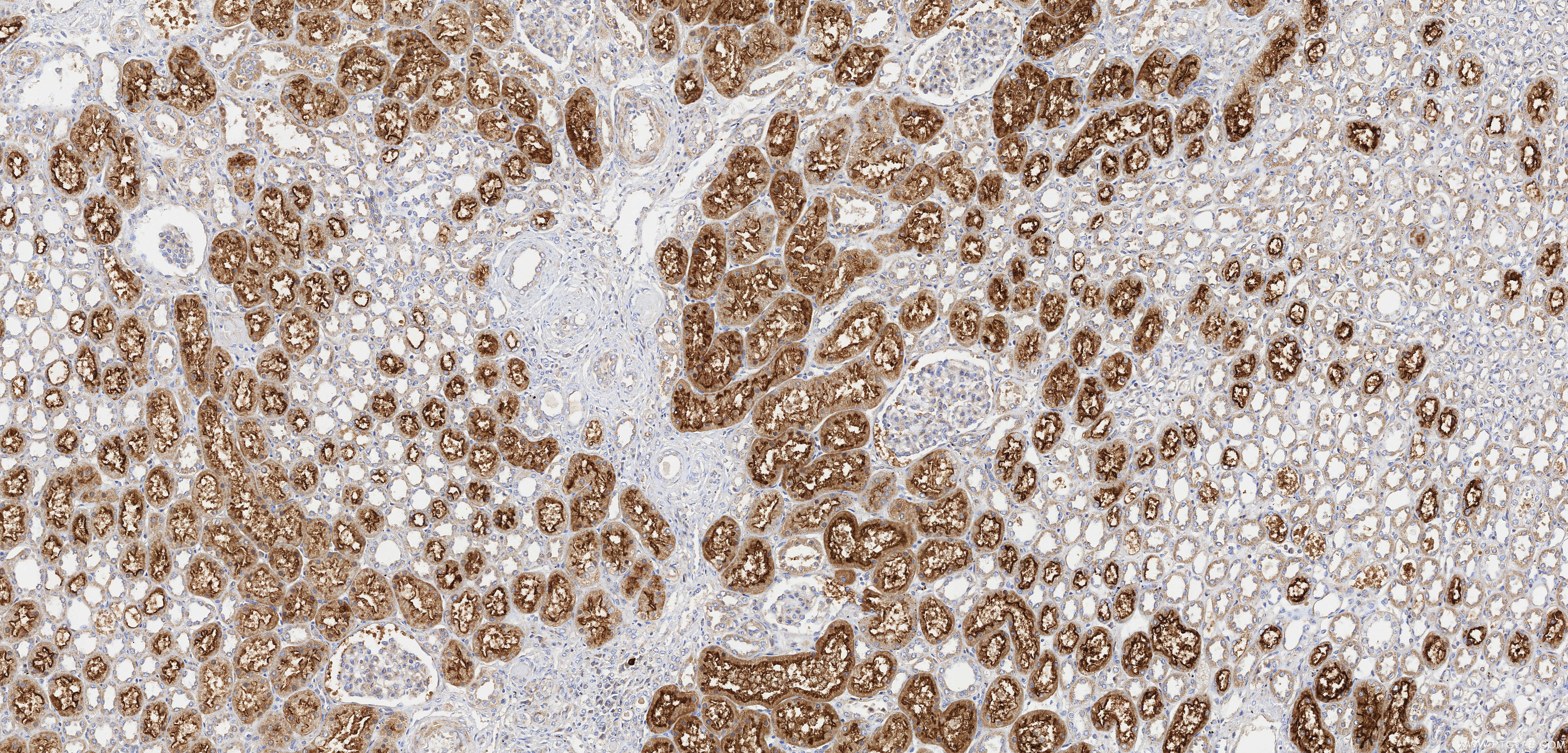 Immunohistochemistry (IHC) staining of human kidney tissue using TMEM27 Recombinant monoclonal antibody (82853-2-RR)