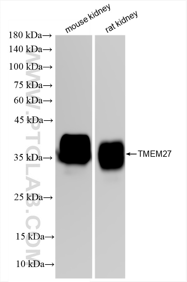 Western Blot (WB) analysis of various lysates using TMEM27 Recombinant antibody (82853-2-RR)