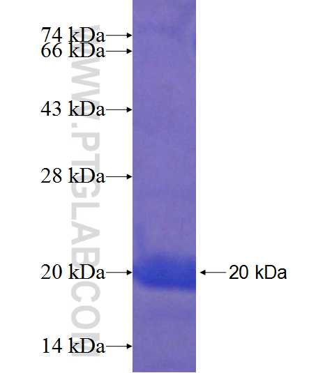 TMEM27 fusion protein Ag21257 SDS-PAGE