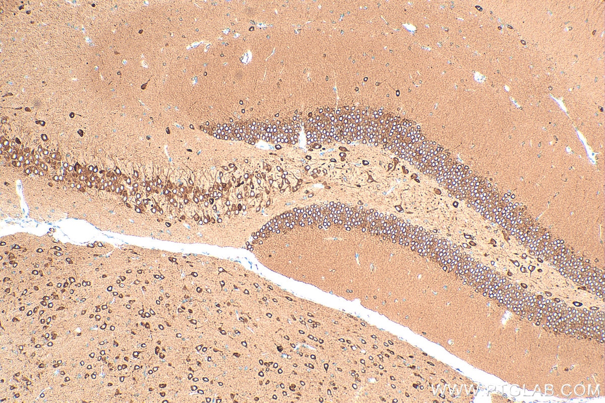 Immunohistochemistry (IHC) staining of mouse brain tissue using TMEM35 Polyclonal antibody (24786-1-AP)