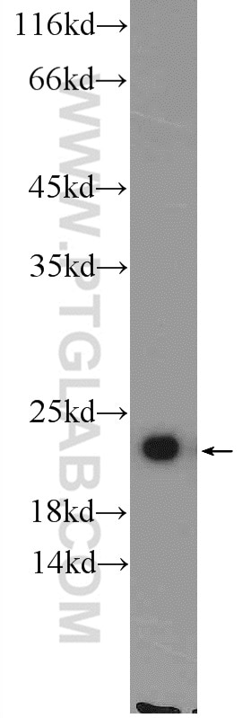 Western Blot (WB) analysis of mouse brain tissue using TMEM35 Polyclonal antibody (24786-1-AP)