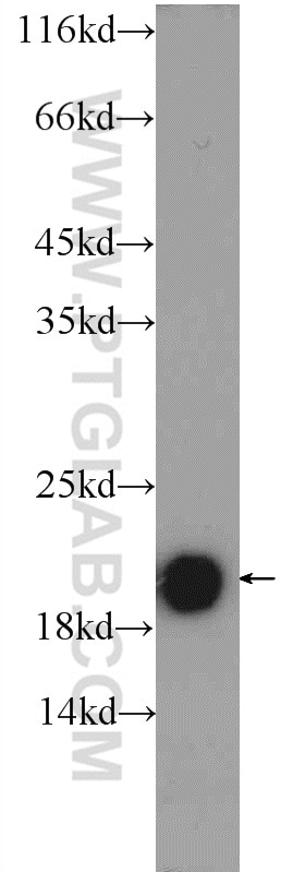 Western Blot (WB) analysis of mouse cerebellum tissue using TMEM35 Polyclonal antibody (24786-1-AP)