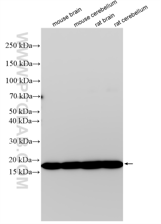 Western Blot (WB) analysis of various lysates using TMEM35 Polyclonal antibody (24786-1-AP)