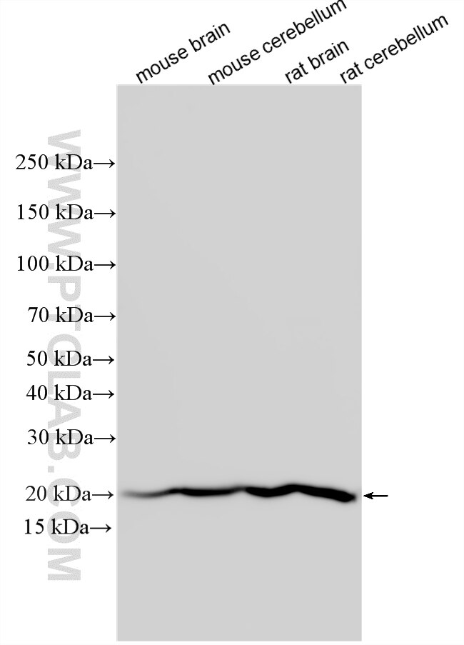 Western Blot (WB) analysis of various lysates using TMEM35 Polyclonal antibody (24786-1-AP)