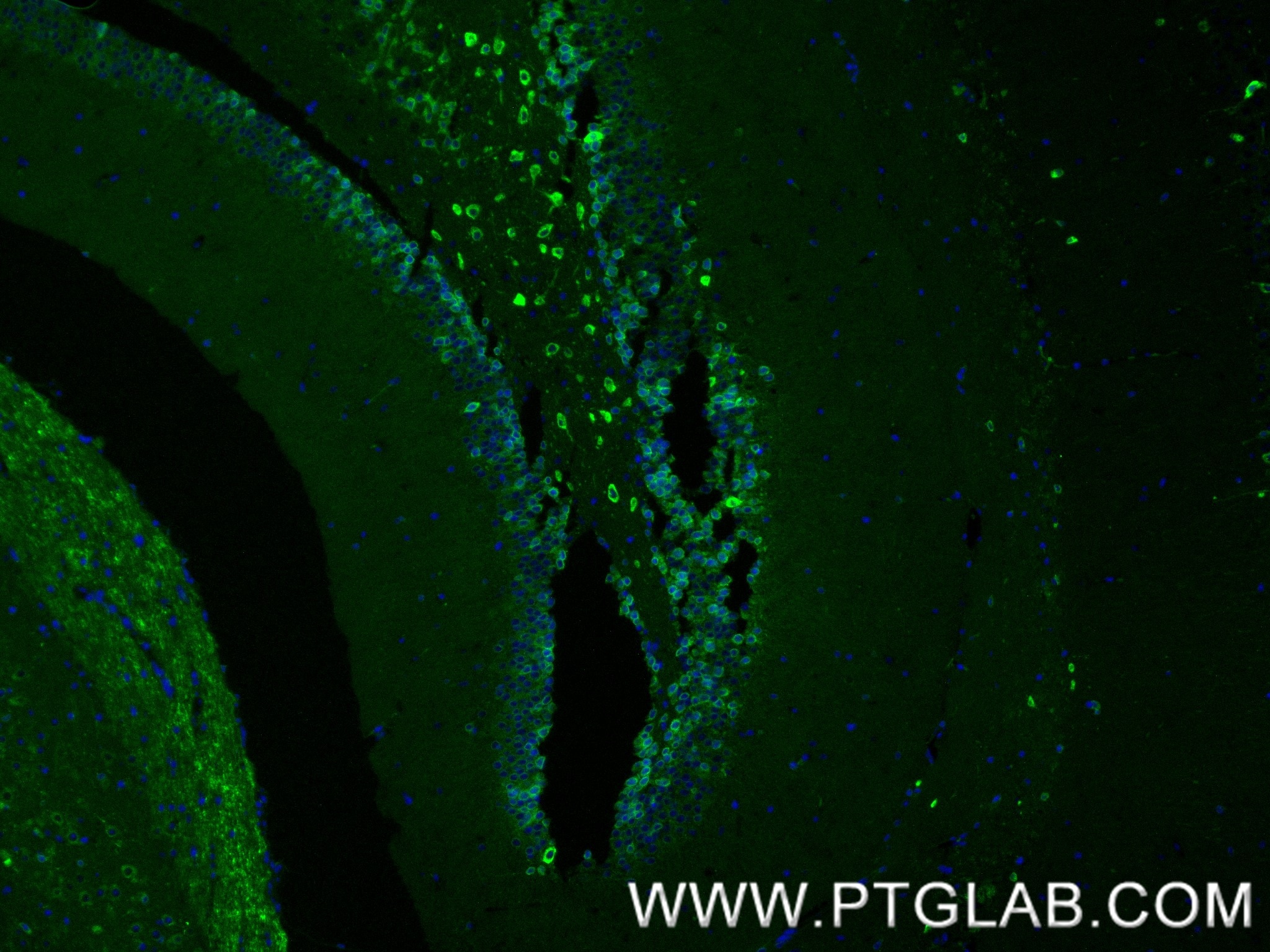IF Staining of mouse brain using 86724-1-RR (same clone as 86724-1-PBS) Immunofluorescence (IF) / fluorescent staining of mouse brain tissue using TMEM35 Recombinant monoclonal antibody (86724-1-RR)
