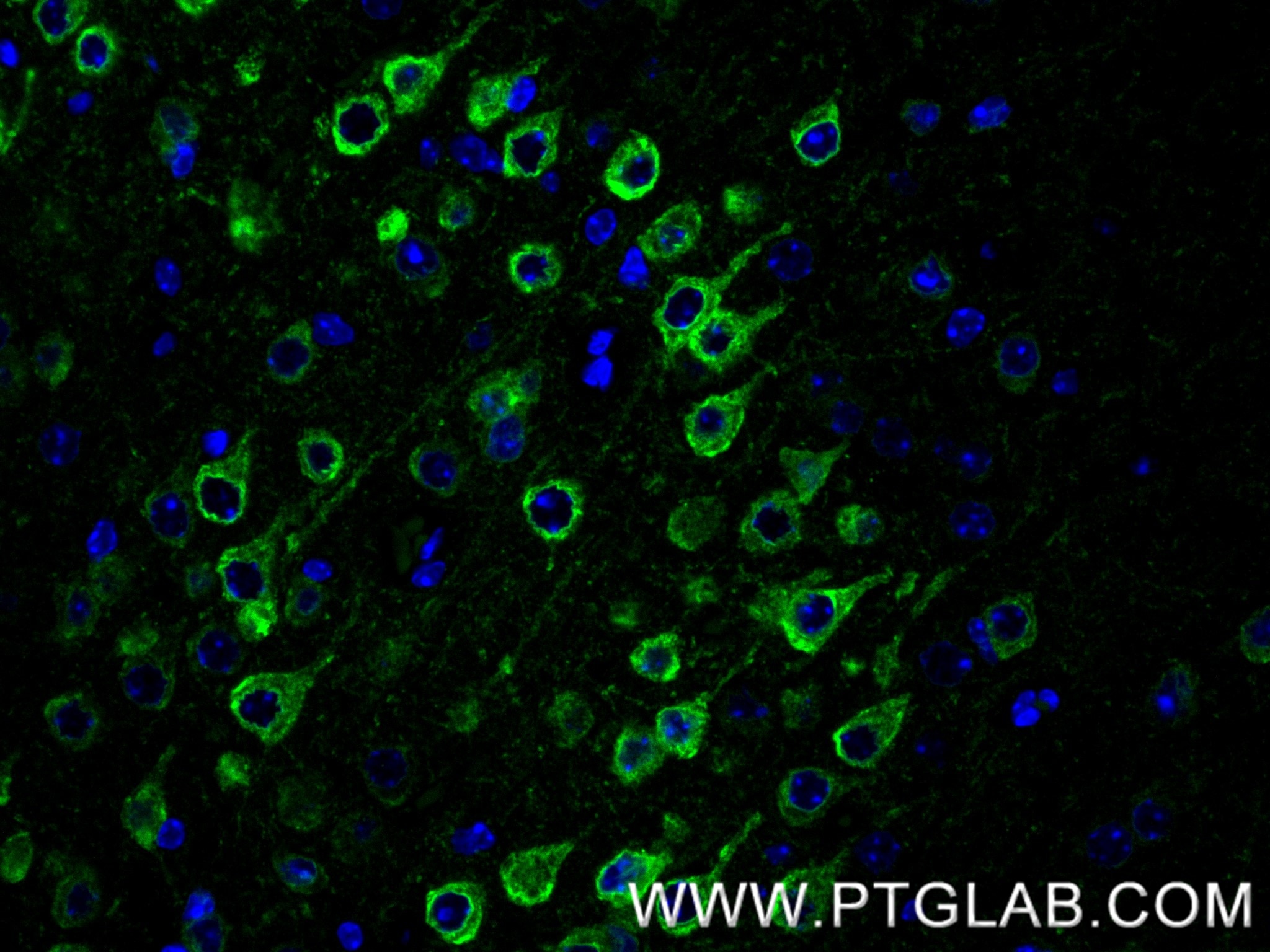 IF Staining of mouse brain using 86724-1-RR (same clone as 86724-1-PBS) Immunofluorescence (IF) / fluorescent staining of mouse brain tissue using TMEM35 Recombinant monoclonal antibody (86724-1-RR)