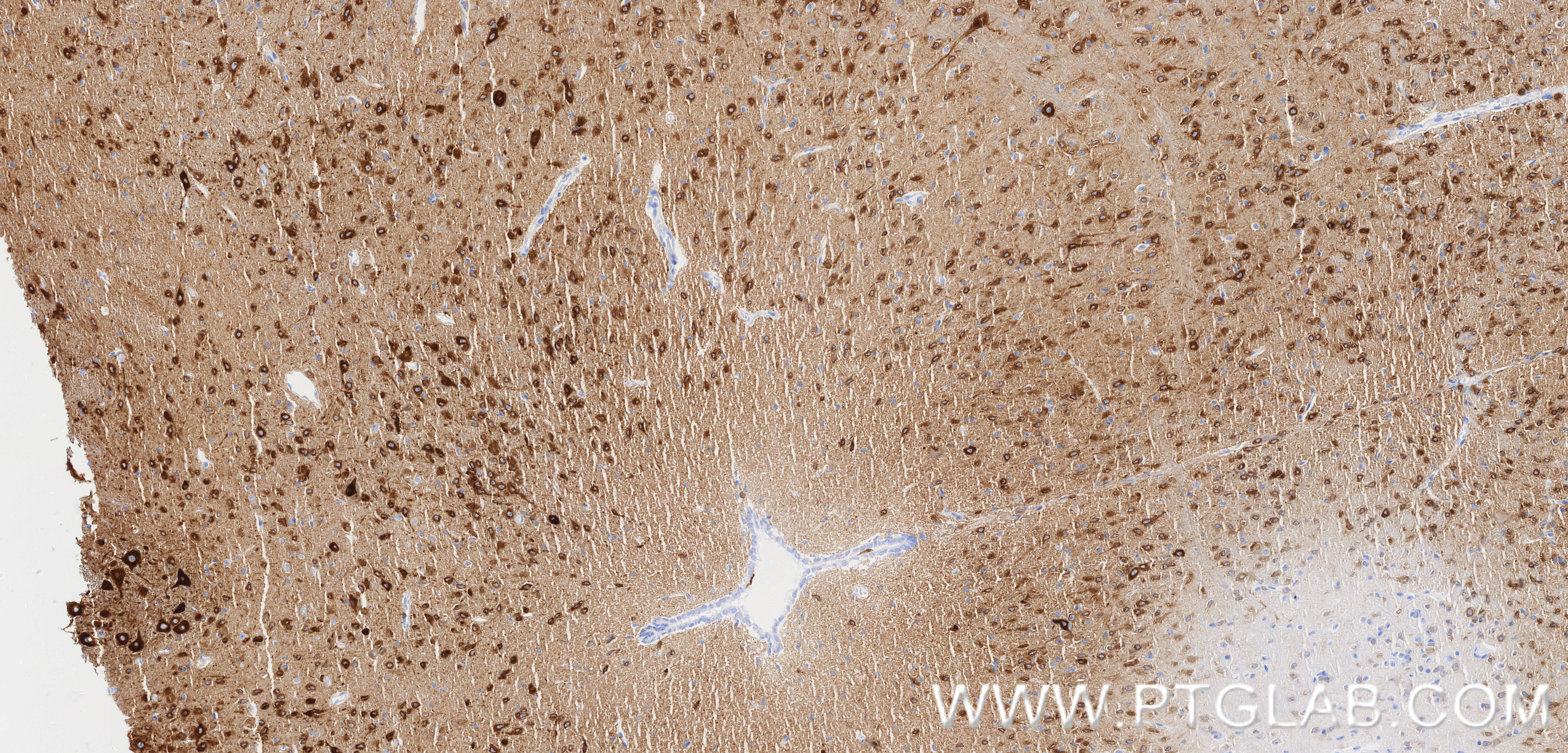 Immunohistochemistry (IHC) staining of mouse brain tissue using TMEM35 Recombinant monoclonal antibody (86724-1-RR)