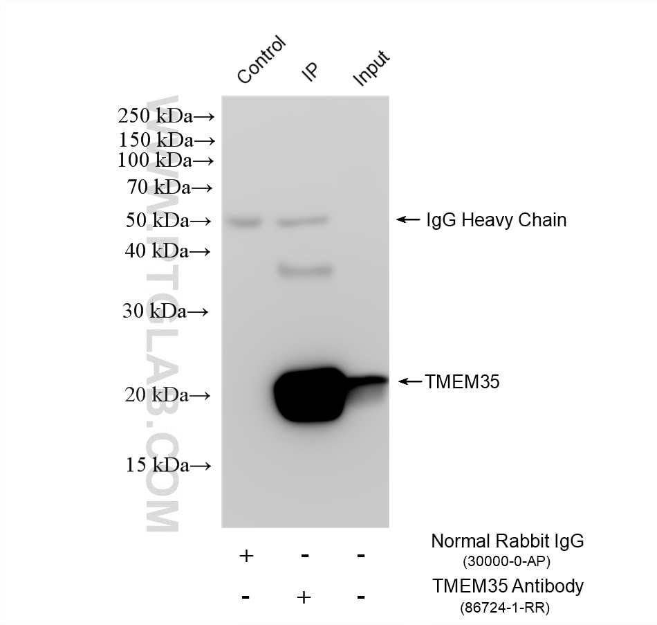 Immunoprecipitation (IP) experiment of mouse brain tissue using TMEM35 Recombinant monoclonal antibody (86724-1-RR)
