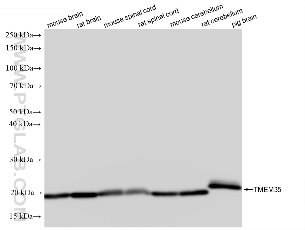 Western Blot (WB) analysis of various lysates using TMEM35 Recombinant monoclonal antibody (86724-1-RR)