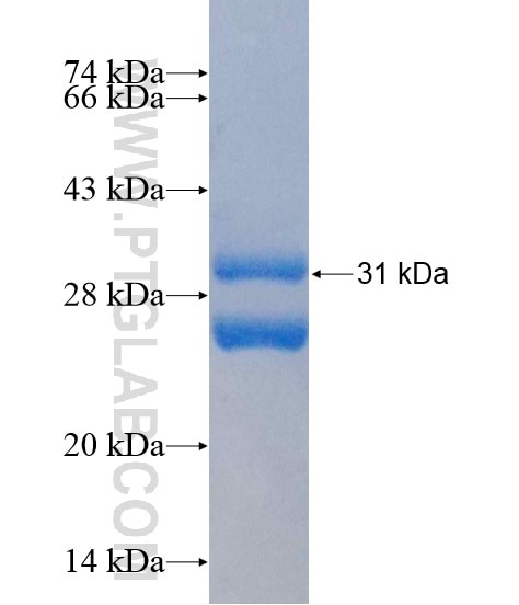 TMEM35 fusion protein Ag20589 SDS-PAGE