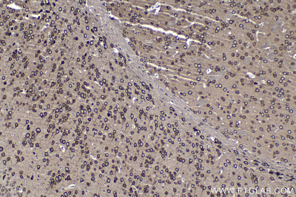 Immunohistochemistry (IHC) staining of mouse brain tissue using TMEM38A Polyclonal antibody (19920-1-AP)