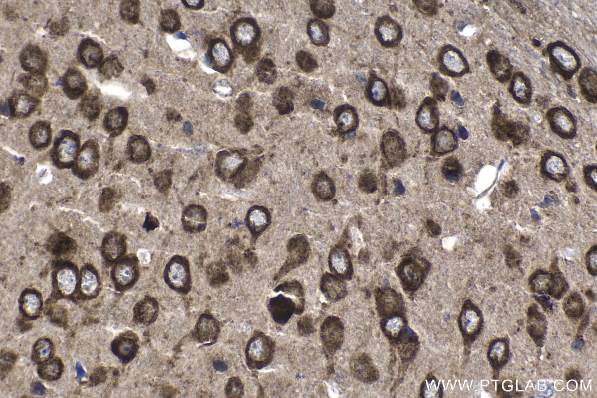 Immunohistochemistry (IHC) staining of mouse brain tissue using TMEM38A Polyclonal antibody (19920-1-AP)