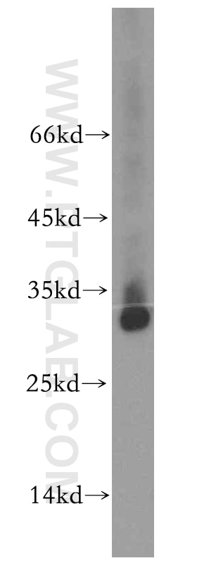 Western Blot (WB) analysis of mouse skeletal muscle tissue using TMEM38A Polyclonal antibody (19920-1-AP)