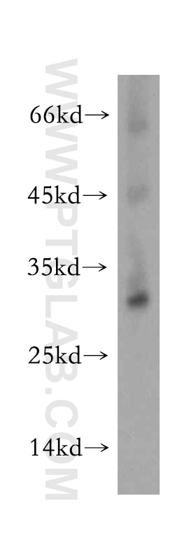 Western Blot (WB) analysis of HeLa cells using TMEM38A Polyclonal antibody (19920-1-AP)
