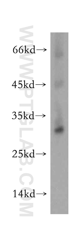 WB analysis of HeLa using 19920-1-AP