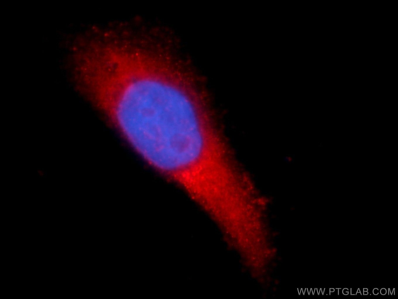 Immunofluorescence (IF) / fluorescent staining of HeLa cells using TMEM38B Polyclonal antibody (19919-1-AP)