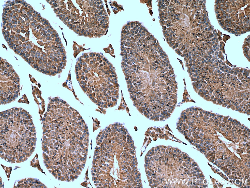 Immunohistochemistry (IHC) staining of mouse testis tissue using TMEM38B Polyclonal antibody (19919-1-AP)