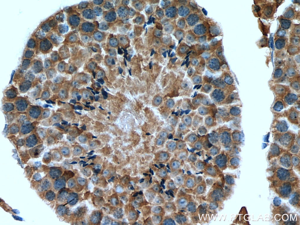 Immunohistochemistry (IHC) staining of mouse testis tissue using TMEM38B Polyclonal antibody (19919-1-AP)