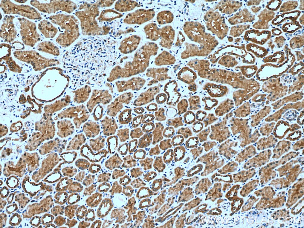 Immunohistochemistry (IHC) staining of human kidney tissue using TMEM38B Polyclonal antibody (19919-1-AP)