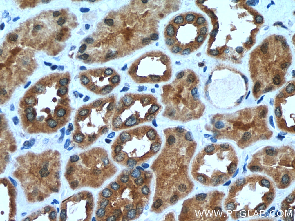 Immunohistochemistry (IHC) staining of human kidney tissue using TMEM38B Polyclonal antibody (19919-1-AP)