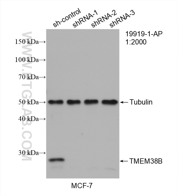 Western Blot (WB) analysis of MCF-7 cells using TMEM38B Polyclonal antibody (19919-1-AP)