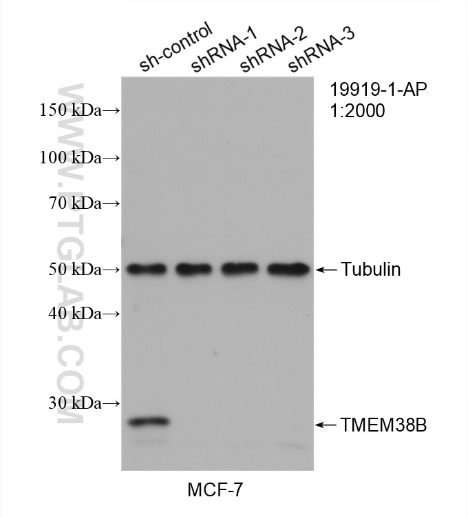 WB analysis of MCF-7 using 19919-1-AP