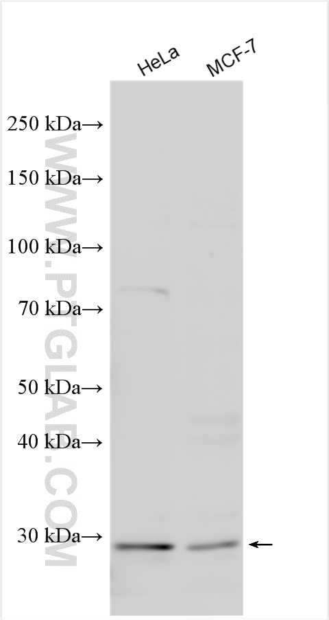 Western Blot (WB) analysis of various lysates using TMEM38B Polyclonal antibody (19919-1-AP)