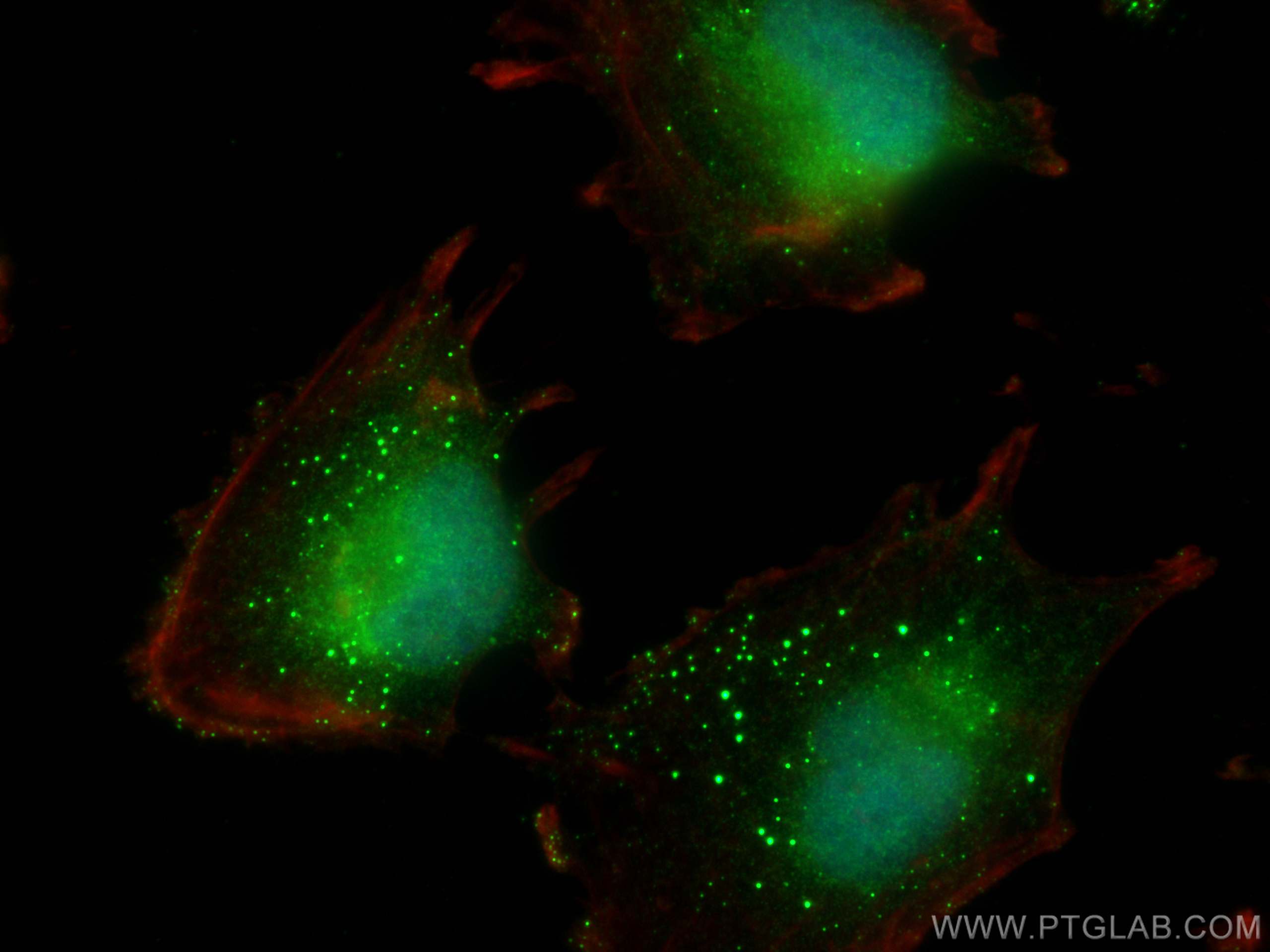 Immunofluorescence (IF) / fluorescent staining of U-251 cells using TMEM39A Polyclonal antibody (20430-1-AP)