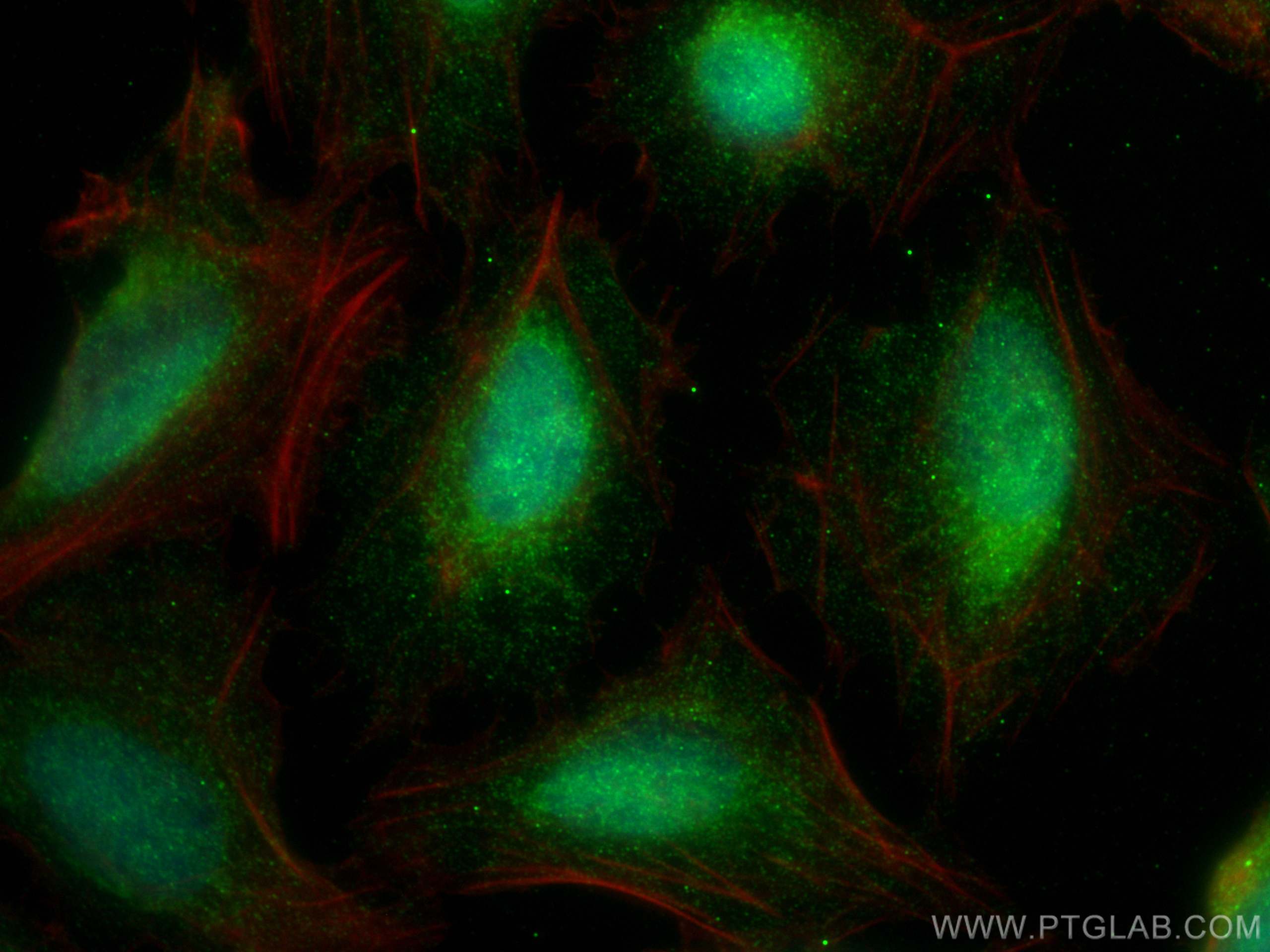 Immunofluorescence (IF) / fluorescent staining of U2OS cells using TMEM39A Polyclonal antibody (20430-1-AP)