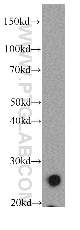 Western Blot (WB) analysis of mouse small intestine tissue using TMEM41A Polyclonal antibody (20768-1-AP)