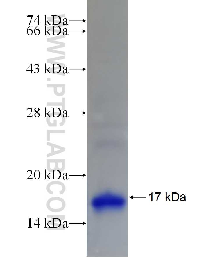 TMEM41A fusion protein Ag15070 SDS-PAGE