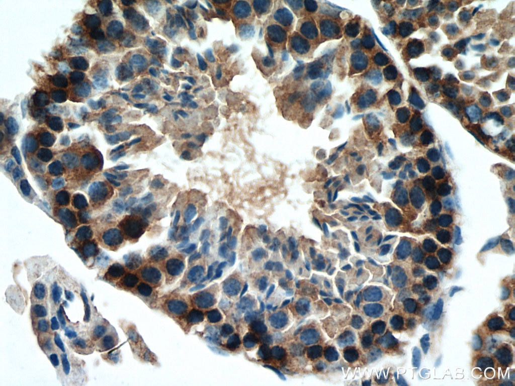 IHC staining of mouse testis using 29270-1-AP