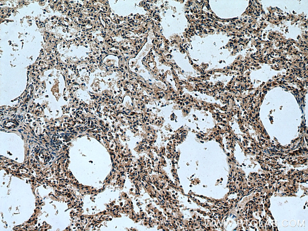 Immunohistochemistry (IHC) staining of human lung tissue using TMEM41B Polyclonal antibody (29270-1-AP)