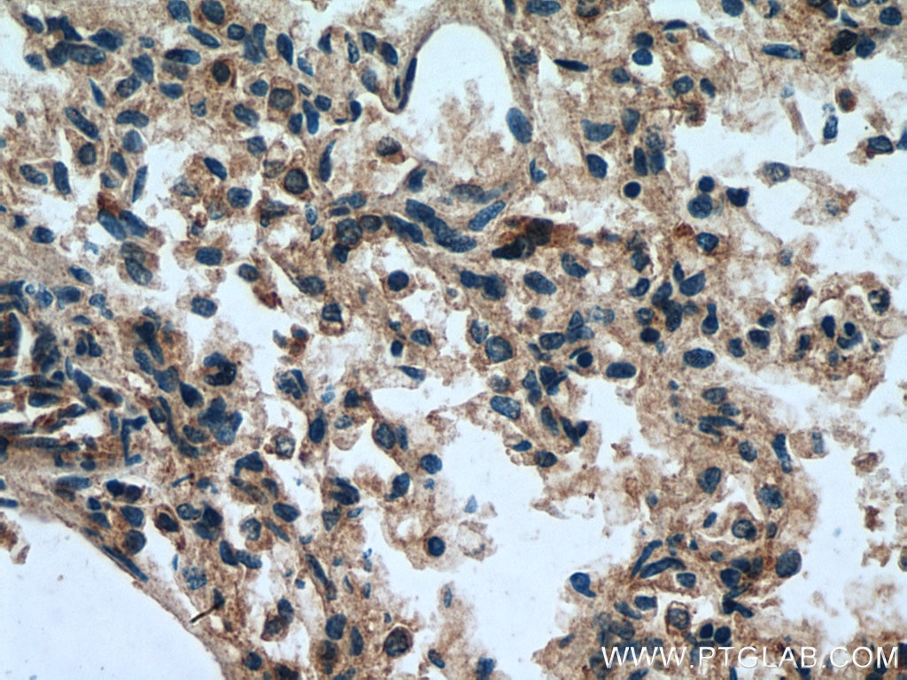Immunohistochemistry (IHC) staining of human lung tissue using TMEM41B Polyclonal antibody (29270-1-AP)