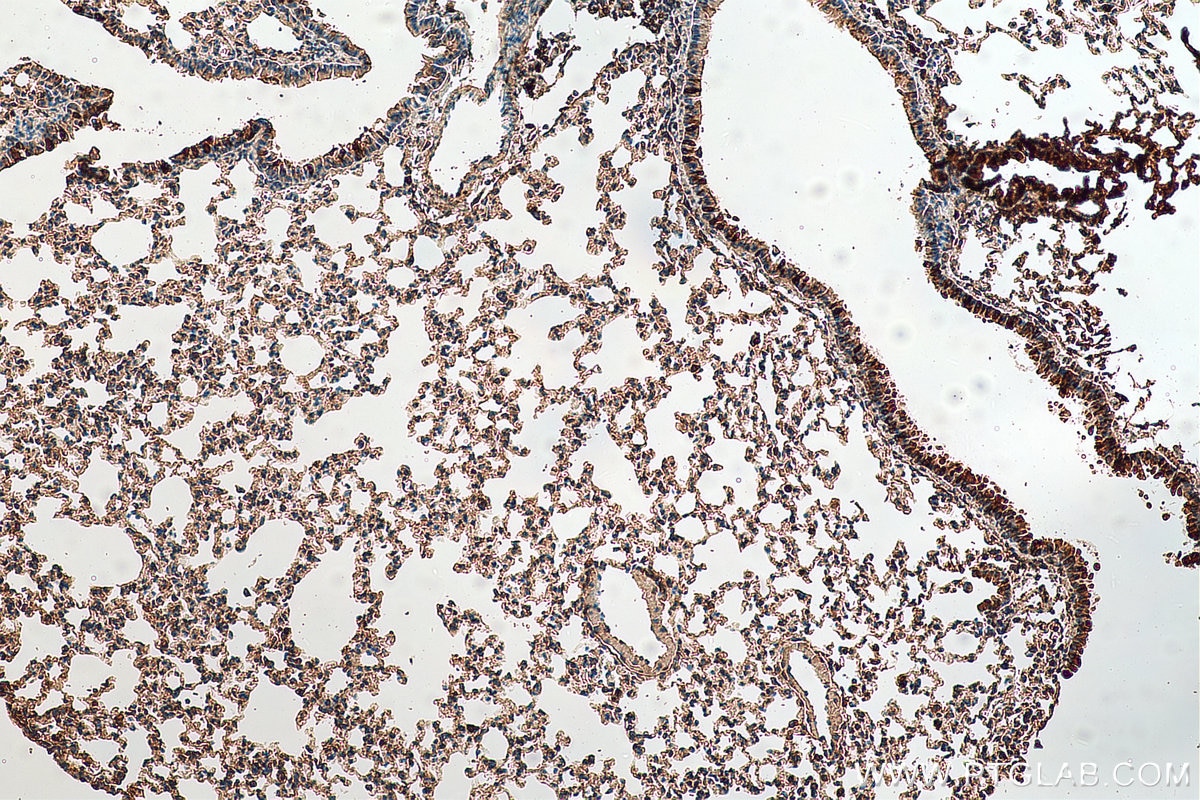 IHC staining of mouse lung using 29270-1-AP