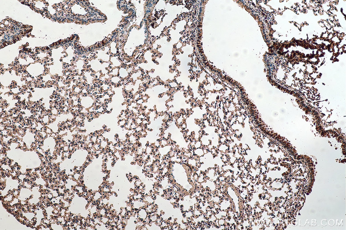 Immunohistochemistry (IHC) staining of mouse lung tissue using TMEM41B Polyclonal antibody (29270-1-AP)