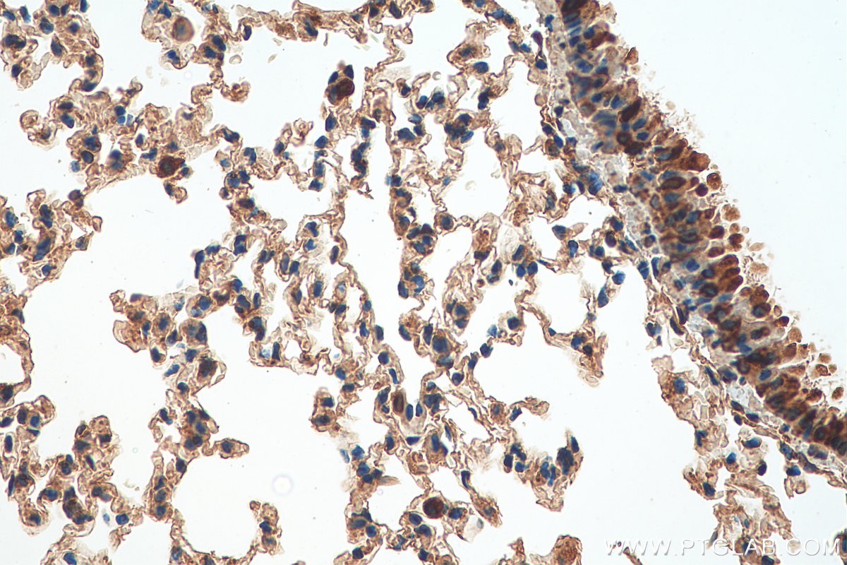 Immunohistochemistry (IHC) staining of mouse lung tissue using TMEM41B Polyclonal antibody (29270-1-AP)