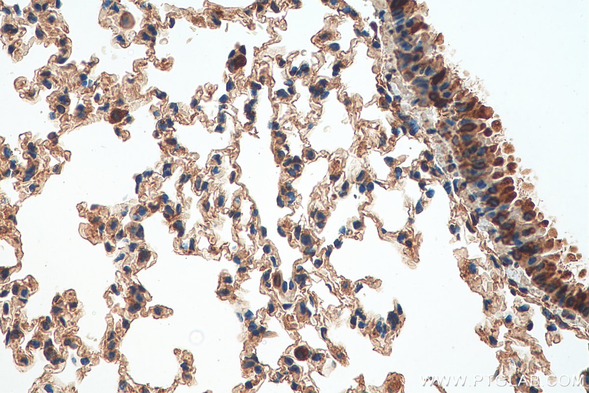 IHC staining of mouse lung using 29270-1-AP