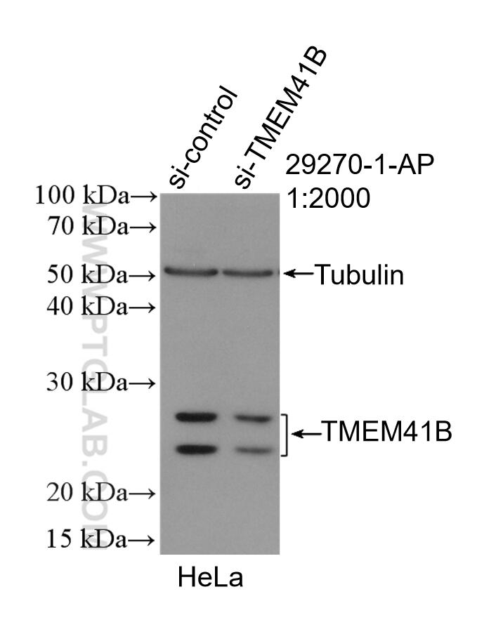Western Blot (WB) analysis of HeLa cells using TMEM41B Polyclonal antibody (29270-1-AP)