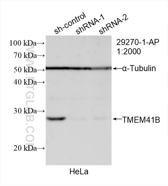 Western Blot (WB) analysis of HeLa cells using TMEM41B Polyclonal antibody (29270-1-AP)